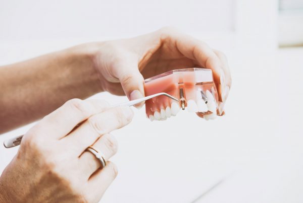 Dental implants smileloft westwood