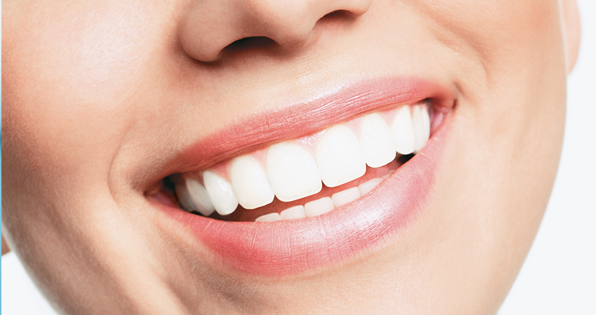 Teeth Whitening