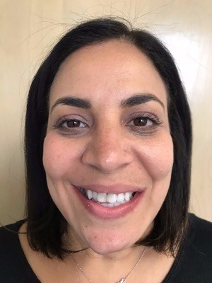 Before Invisalign