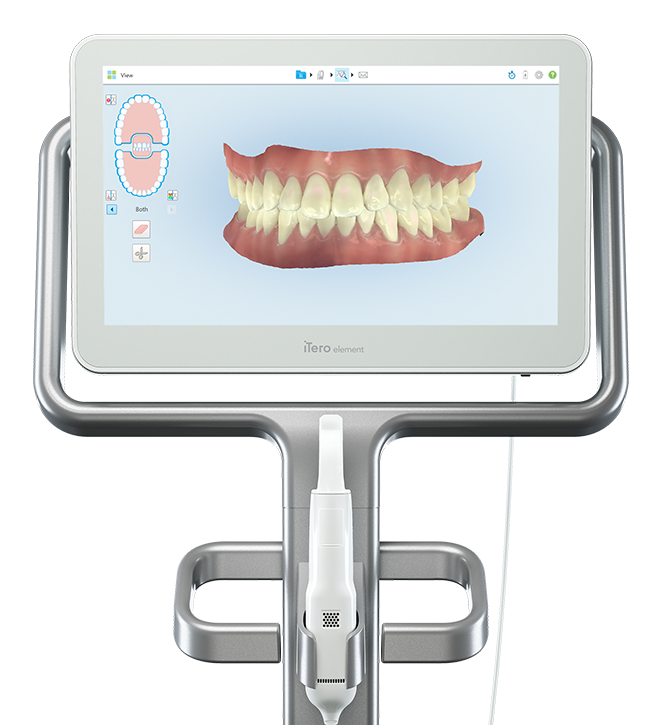Itero Element Intraoral Scanner